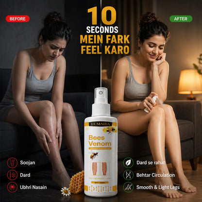 Bee Venon Varicose Veins Spray - BUY 1 GET 1 FREE