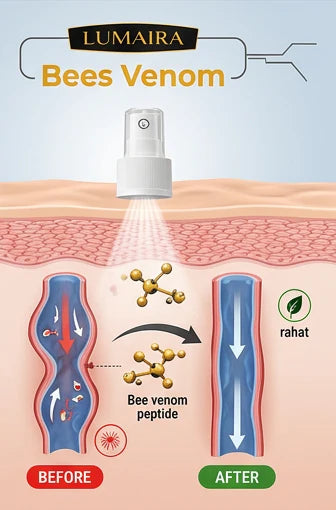 Bee Venon Varicose Veins Spray - BUY 1 GET 1 FREE